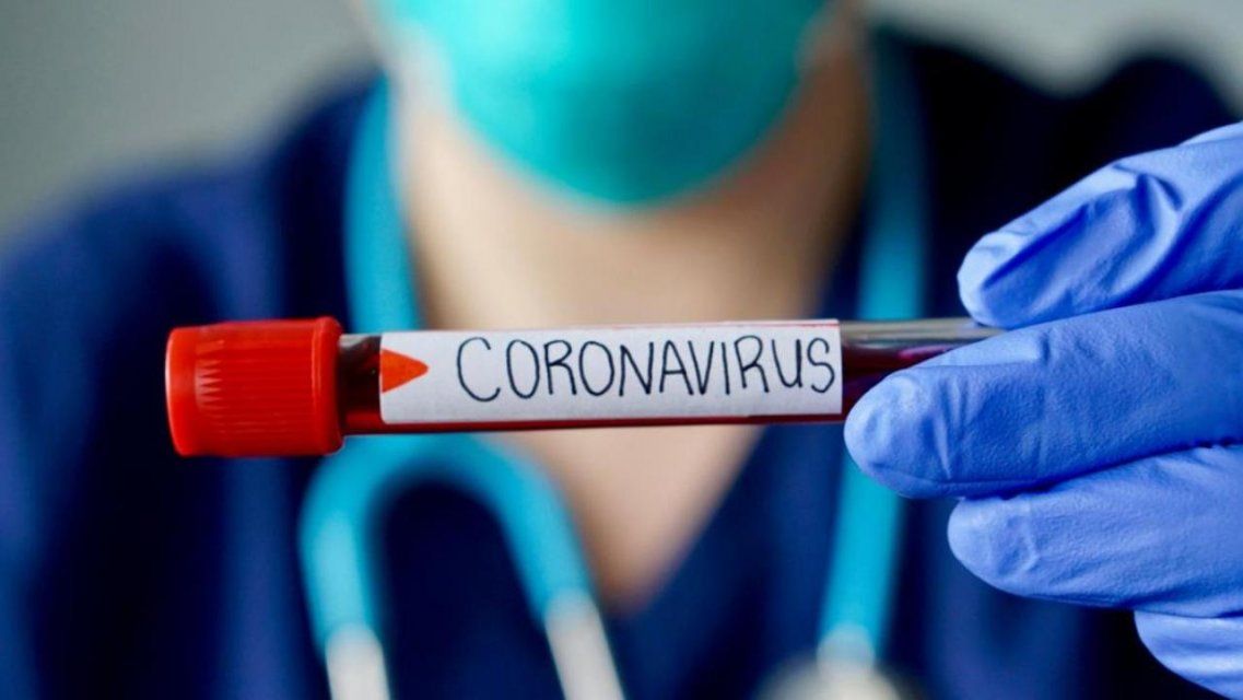 За сутки диагноз COVID-19 подтвердился еще у 54 орловчан