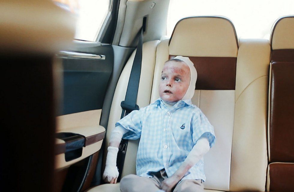 В рамках проекта «Мечтай со мной» волонтеры исполнили мечту «ребенка-бабочки» из Орла