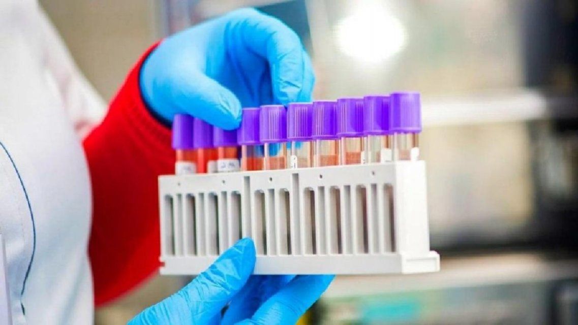 На Орловщине стало известно о смерти еще двух пациентов с коронавирусом