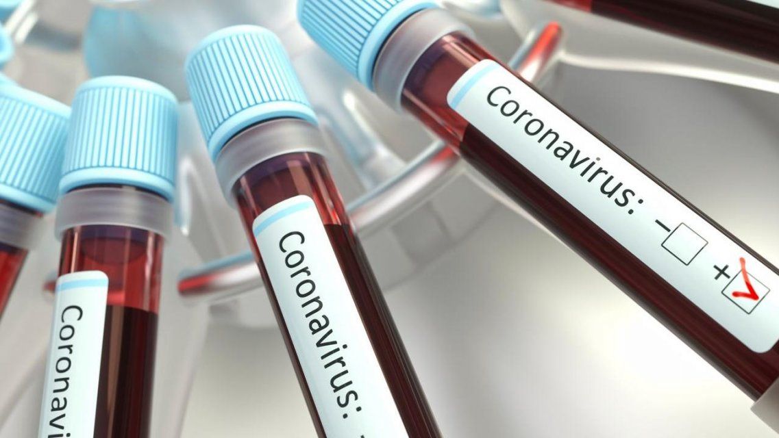 Были случаи, когда орловчан отправляли сдавать тест на COVID-19 за свой счет