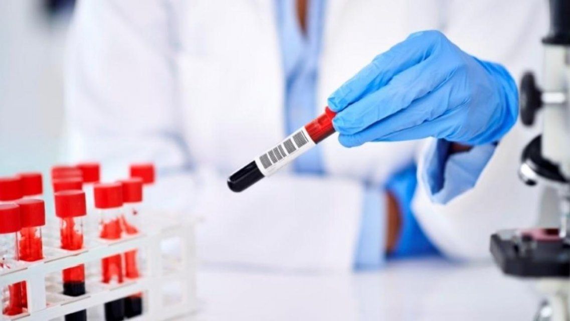 +50 за сутки: заболеваемость коронавирусом на Орловщине не идет на спад