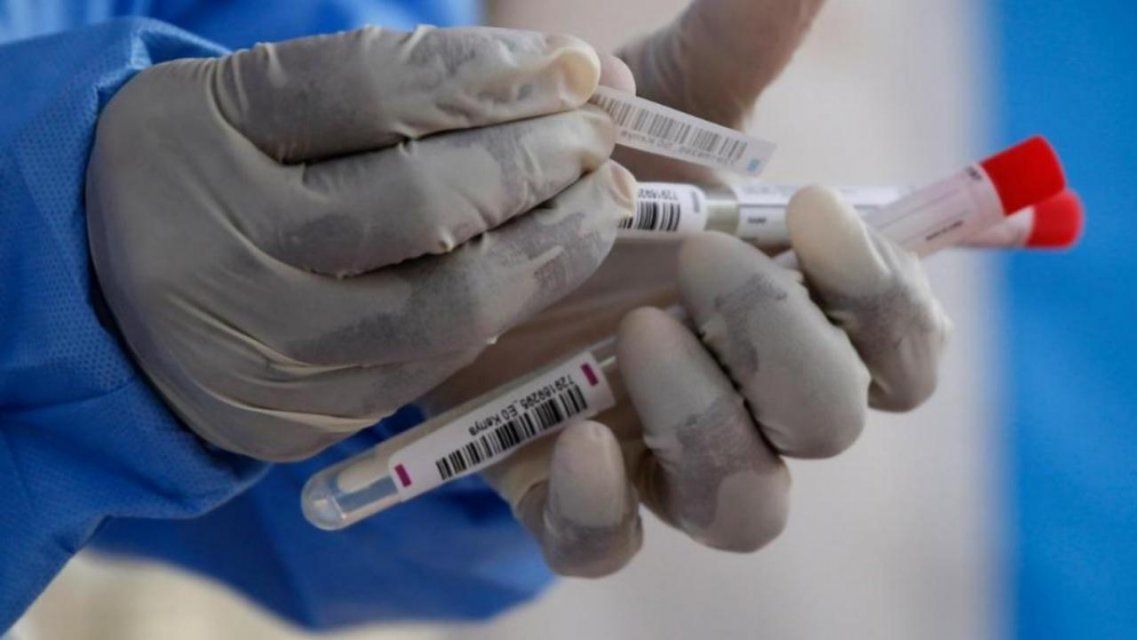 Новые данные по COVID: +136 случаев на Орловщине, а Россия побила суточный рекорд