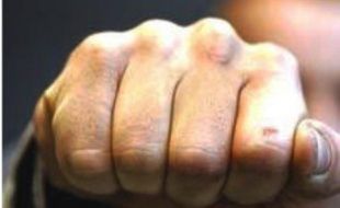 В Орле двое парней избили прохожего