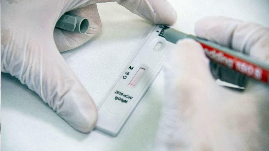 На Орловщине начали экспериментировать с экспресс-тестами на COVID-19