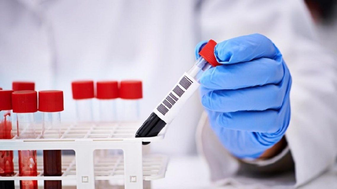 Ни дня без новых случаев: на Орловщине еще у 57 человек нашли COVID-19