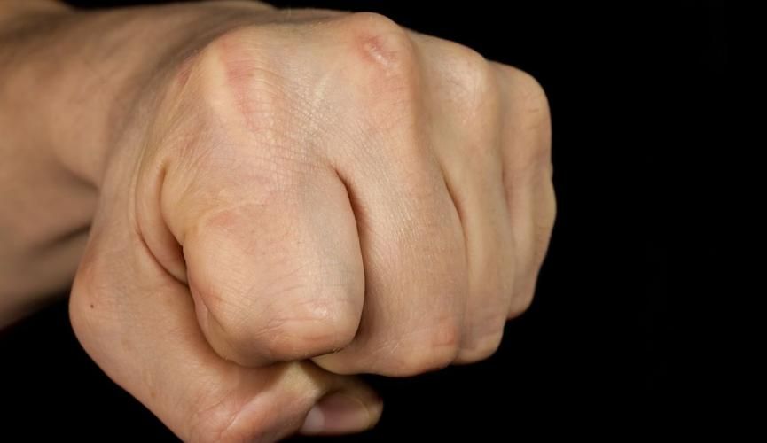 Драка под градусом: подвыпивший гость избил орловчанина