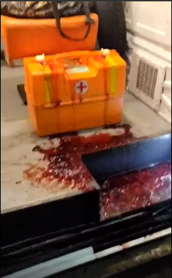 На Орловской областной станции скорой помощи машины от крови пациентов, страдающих опасными заболеваниями мыть некому