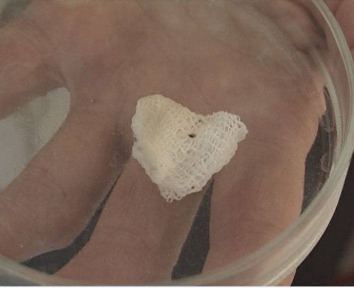 С 13 по 16 апреля парки Орла будут обрабатывать от клещей