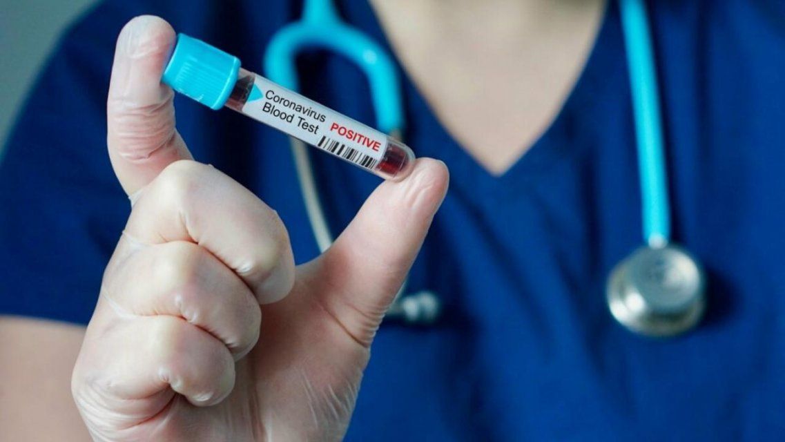 На Орловщине нашли коронавирус у еще одного человека