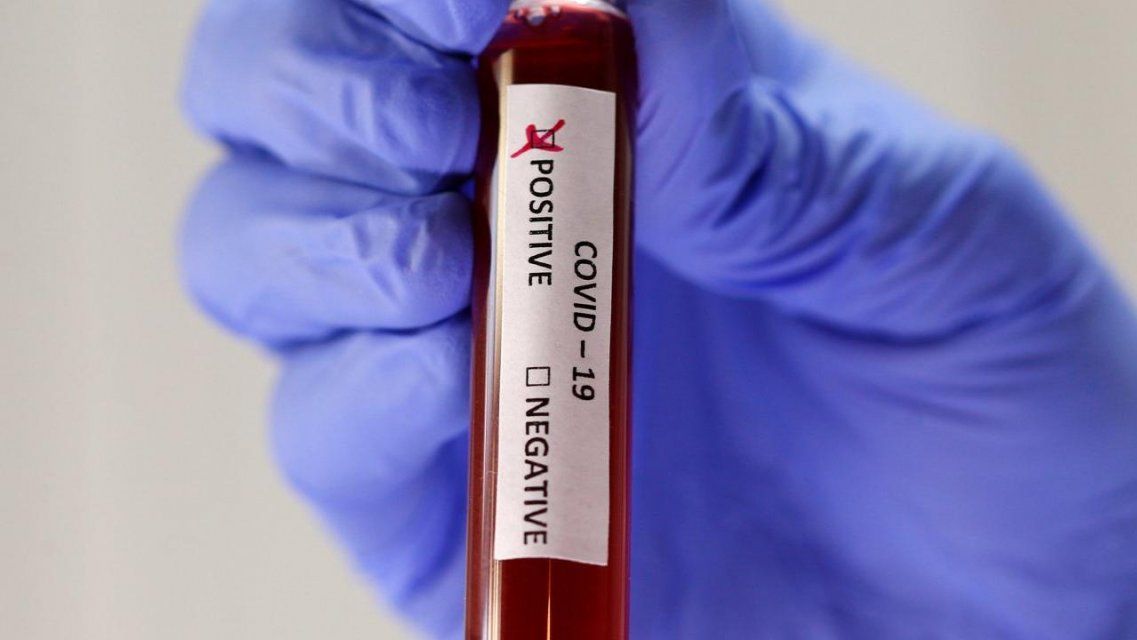 Коронавирус в Болхове: 3 жителя с подтвержденным диагнозом