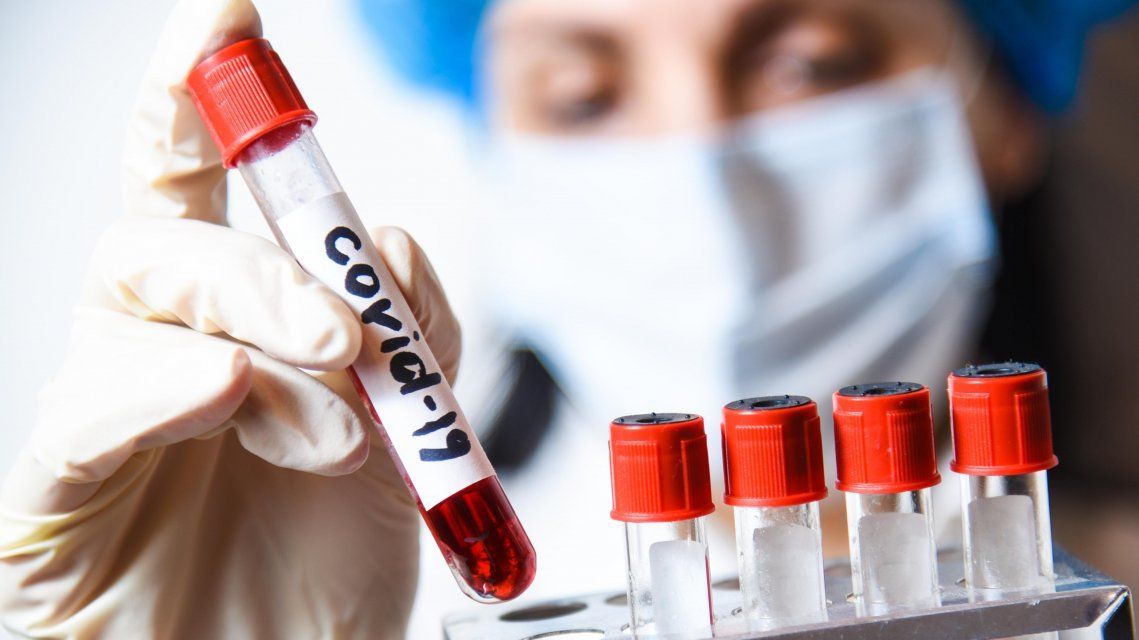 На Орловщине коронавирус нашли еще у 170 человек