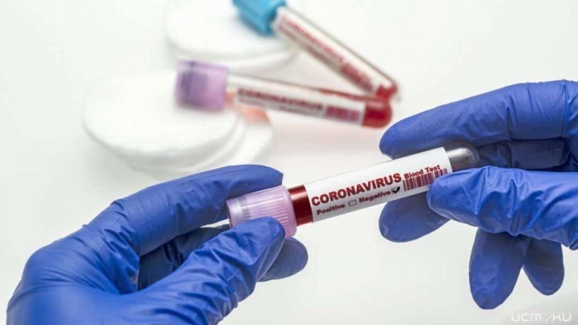 На Орловщине за сутки прибавилось 58 человек, заразившихся коронавирусом