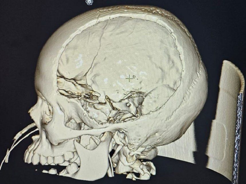 Орловские врачи спасли ребенка с редким заболеванием