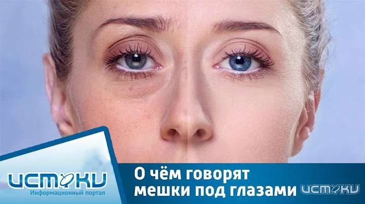 Как убрать малярные мешки?