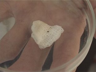 Клещи снова атакуют ? 