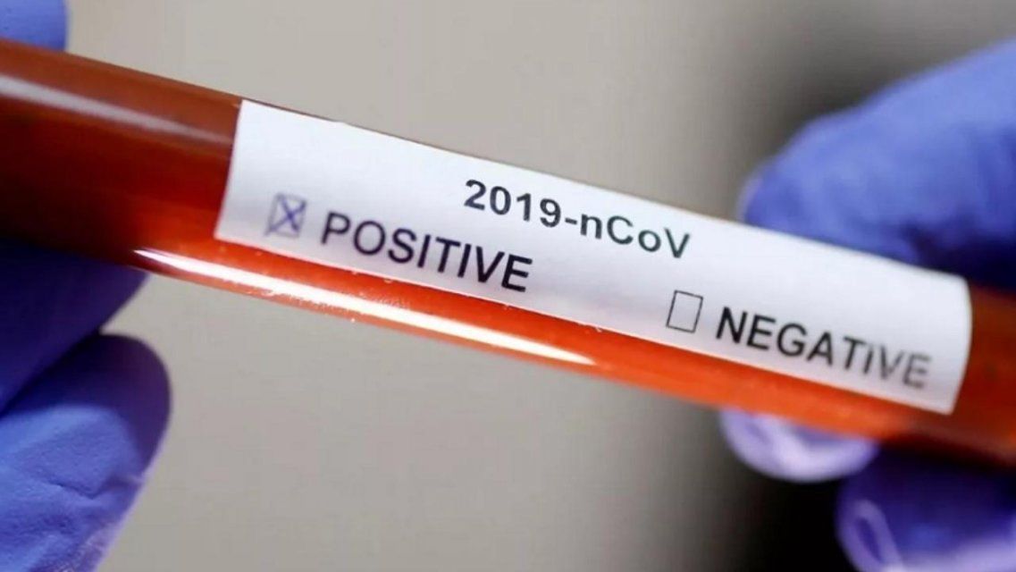 На Орловщине сделали более 30 тысяч тестов на коронавирус