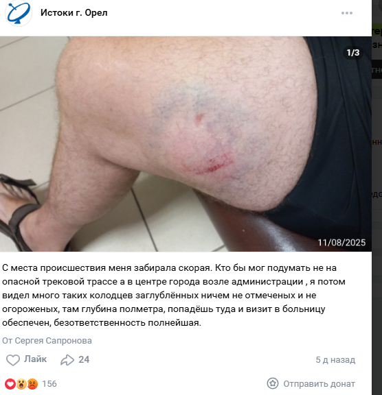 Полученная в центре города травма принесла орловчанину победу в конкурсе «Народный корреспондент»