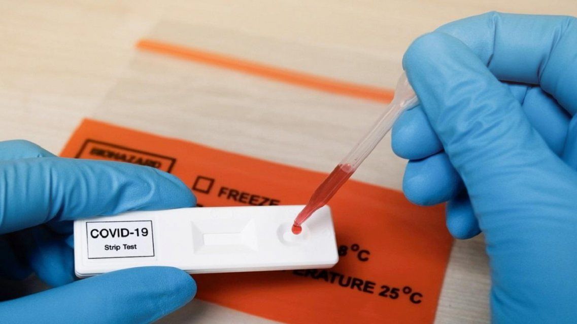 Орловский Роспотребнадзор запускает горячую линию по вопросам тестирования на COVID