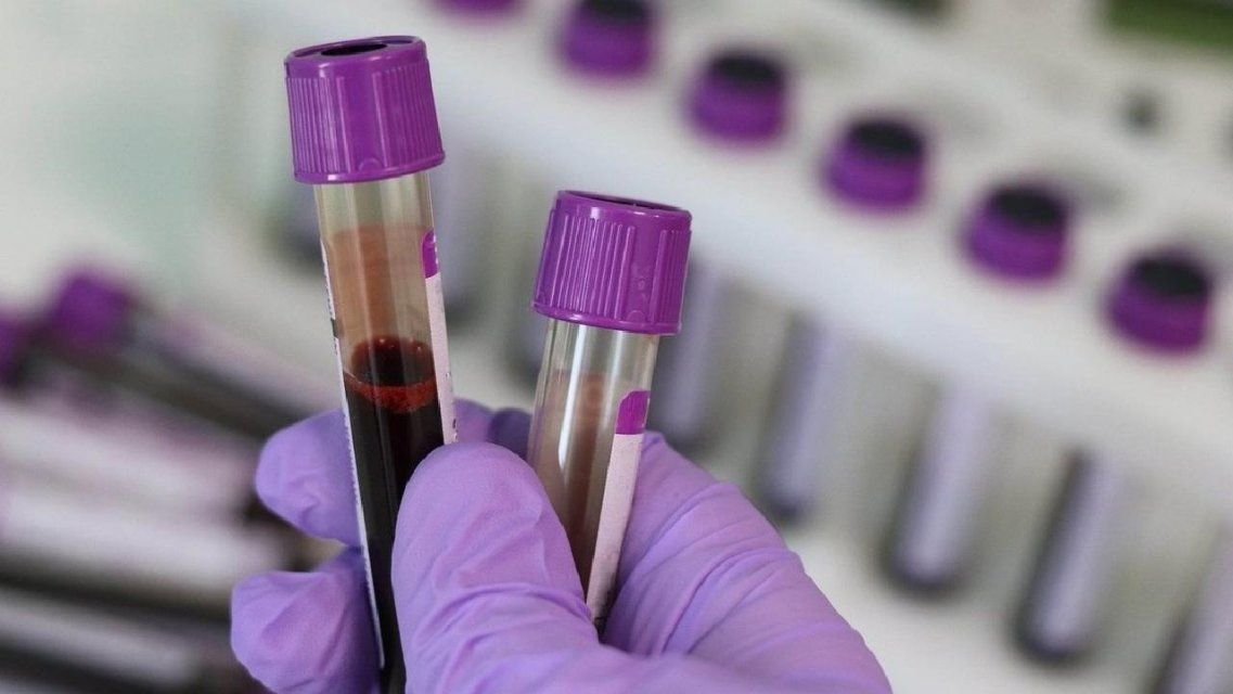 +85 за сутки: число зараженных COVID-19 на Орловщине стремительно растет