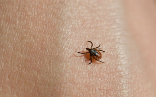 Более 1300 жителей Орловской области покусали клещи