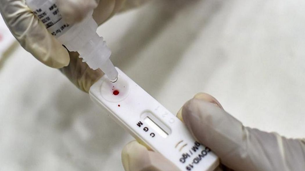 Цены на ПЦР-тесты на Орловщине снизились - ОНФ