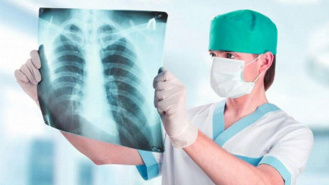 На Орловщине почти 70 % больных пневмонией поздно обращаются к медикам