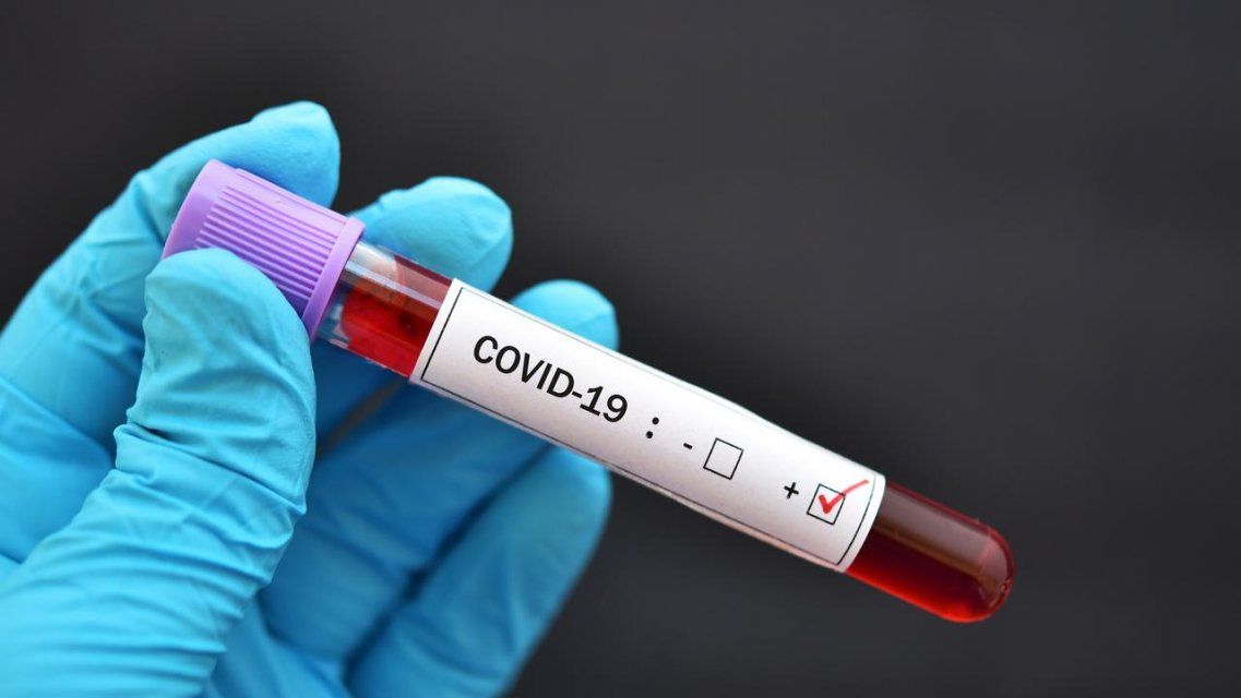 +32 заболевших и 63 выздоровевших: новые данные по COVID-19 на Орловщине