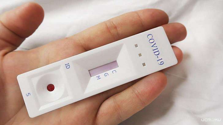 Экспресс-тесты на COVID-19 не будут широко применяться на Орловщине
