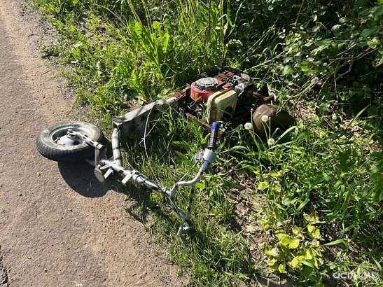 Житель Орловщины после проезда на самодельном самокате попал в больницу