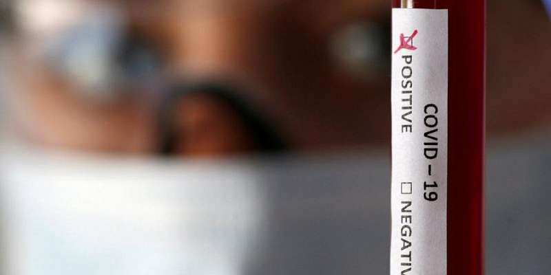 +65: на Орловщине число зараженных коронавирусом превысило 4000