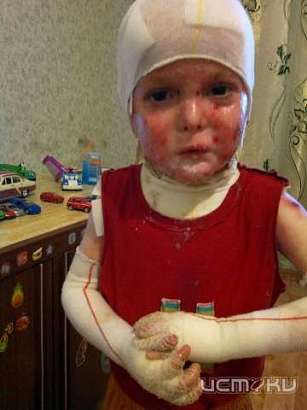 Трехлетнему малышу Исмаилу срочно требуется помощь!