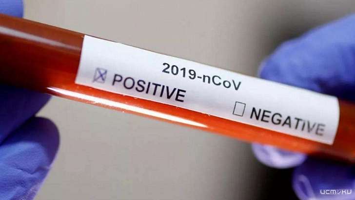 На Орловщине сделали более 30 тысяч тестов на коронавирус