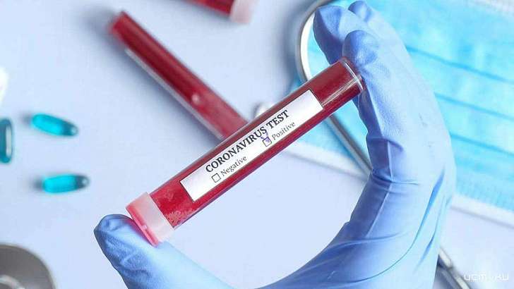 Коронавирус подхватили еще 43 жителя Орловщины