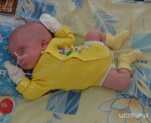 В Орловской области срочно требуется помощь 10-месячному малышу!