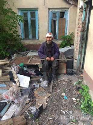 Пожилому мужчине срочно требуется помощь