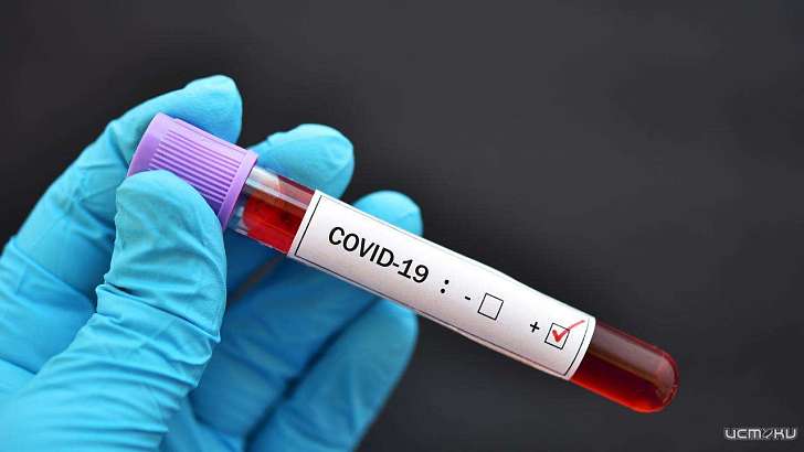 Еще один пациент умер, 22 заразились: новые данные по COVID на Орловщине