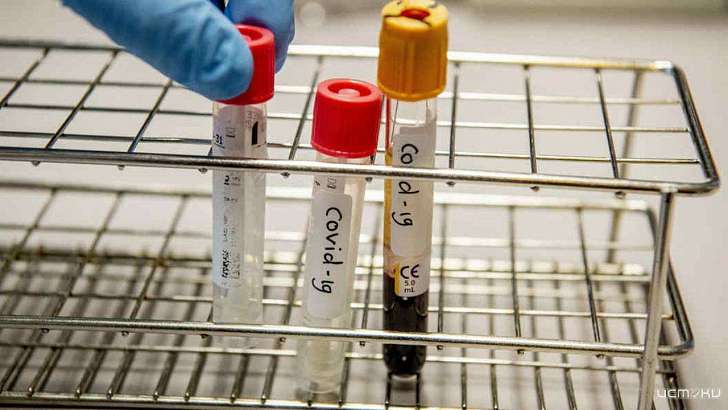 Орловчане могут сдать тест на коронавирус в 5 учреждениях города