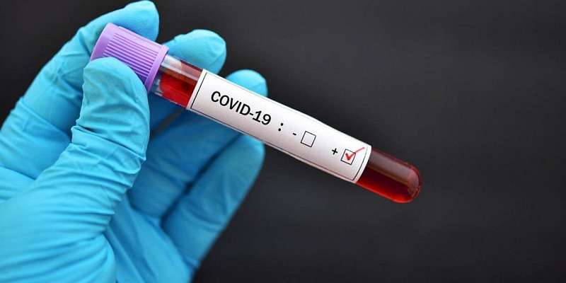 Статистику Орловщины пополнил еще один летальный случай COVID-19