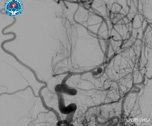 Орловские врачи провели сложнейшую операцию на мозге и спасли пациента