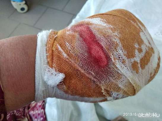 После нападения пса на орловчанку правозащитники просят Клычкова принять меры