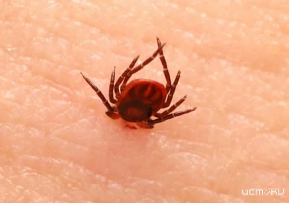 Более 300 орловчан пострадали от укусов клещей