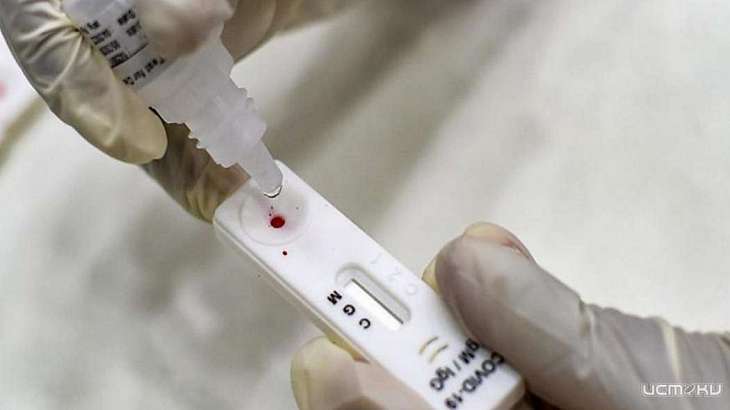 Цены на ПЦР-тесты на Орловщине снизились - ОНФ