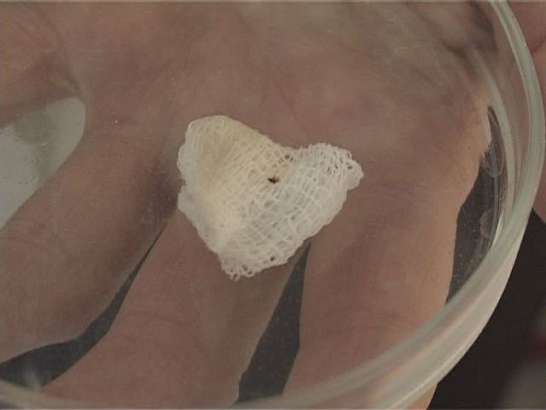 Клещи снова атакуют ? 