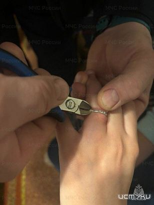 Орловчанка смогла избавиться от кольца только с помощью спасателей