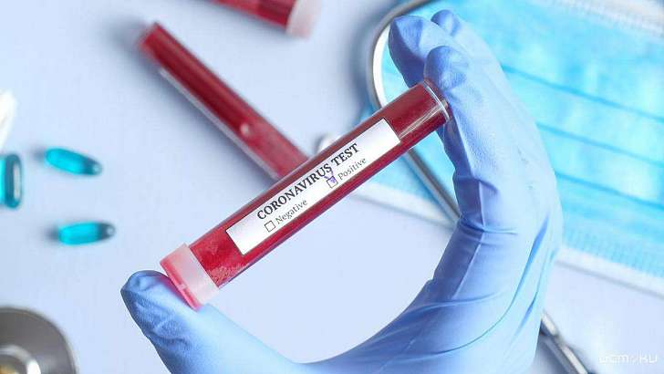 Еще двое пациентов с COVID-19 умерли в Орловской области