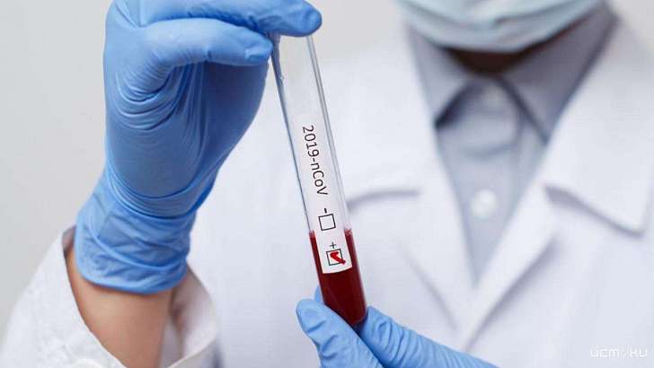 Еще у 112 орловчан нашли коронавирус