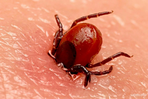 В Орловской области сезон клещей в разгаре! 