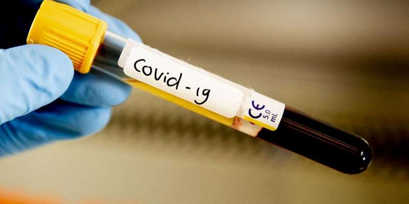 Из почти 3000 обследованных орловчан антитела к COVID-19 нашли у 151