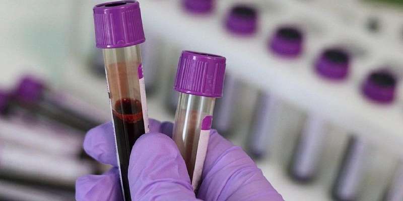 Еще у 35 орловчан нашли коронавирус, 2911 пациентов выздоровели