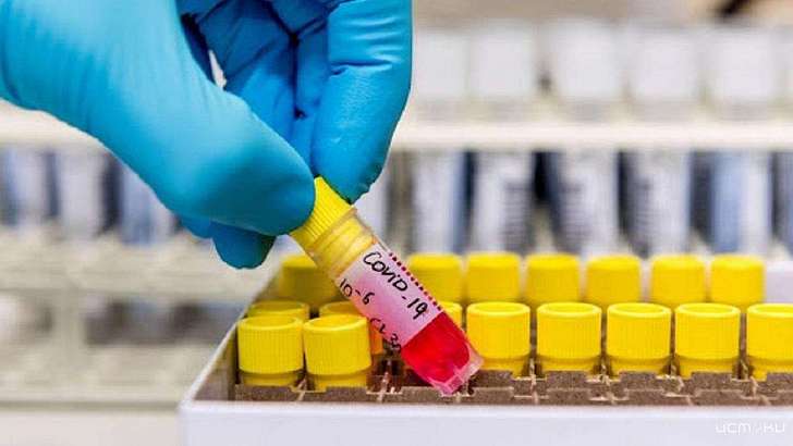 Россия бьет рекорды по числу больных, а на Орловщине еще два COVID-пациента не выжили